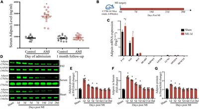 Exosomes derived from pericardial adipose tissues attenuate cardiac remodeling following myocardial infarction by Adipsin-regulated iron homeostasis